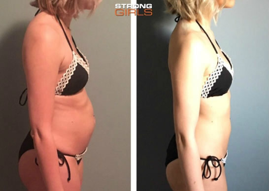 before-after11