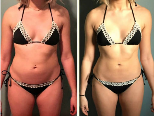 before-after22