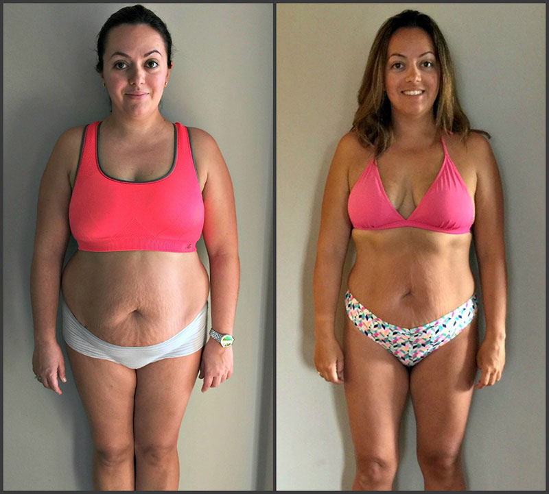 before-after-2